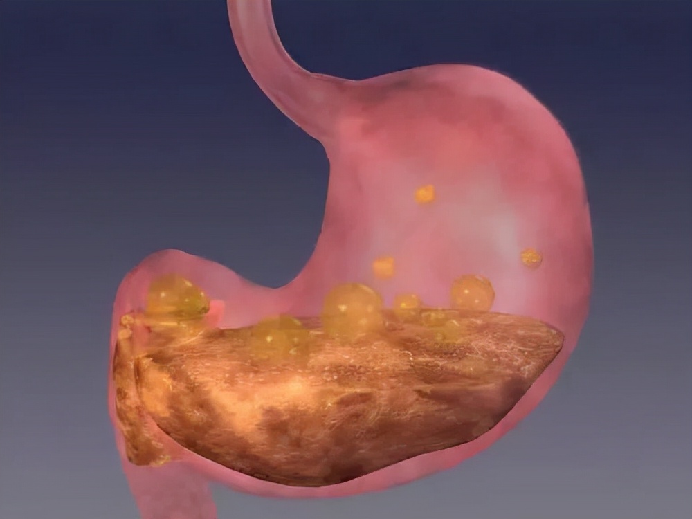 胃不舒服消化科医生给你6条建议,消化内科主任教你判断胃病