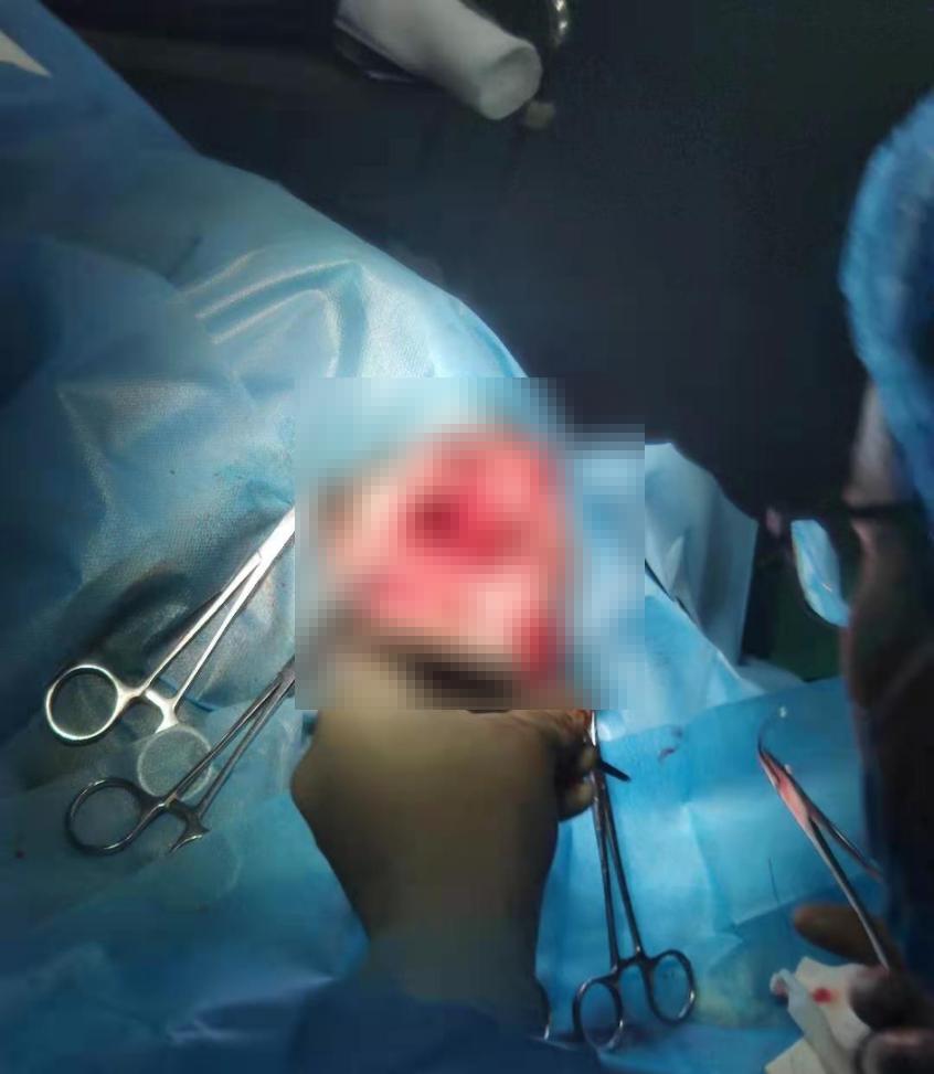 狗狗肚脐鼓包长大后能自愈吗,狗会阴疝复发咋办