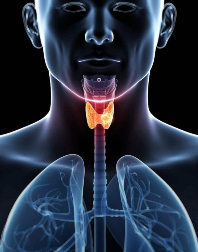 甲状腺癌能不能评残疾,为什么说甲状腺癌是最幸福的癌症