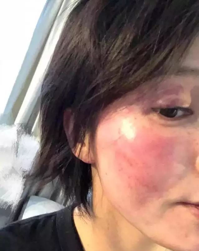 被绿又被打？还为爱自杀？至于吗