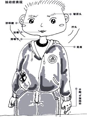 李丽曼谈儿童抽动症,儿科李丽曼