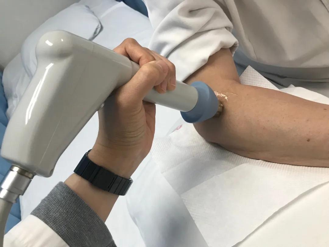 胳膊肘疼痛说是网球炎怎么治疗,网球肘两个胳膊都痛