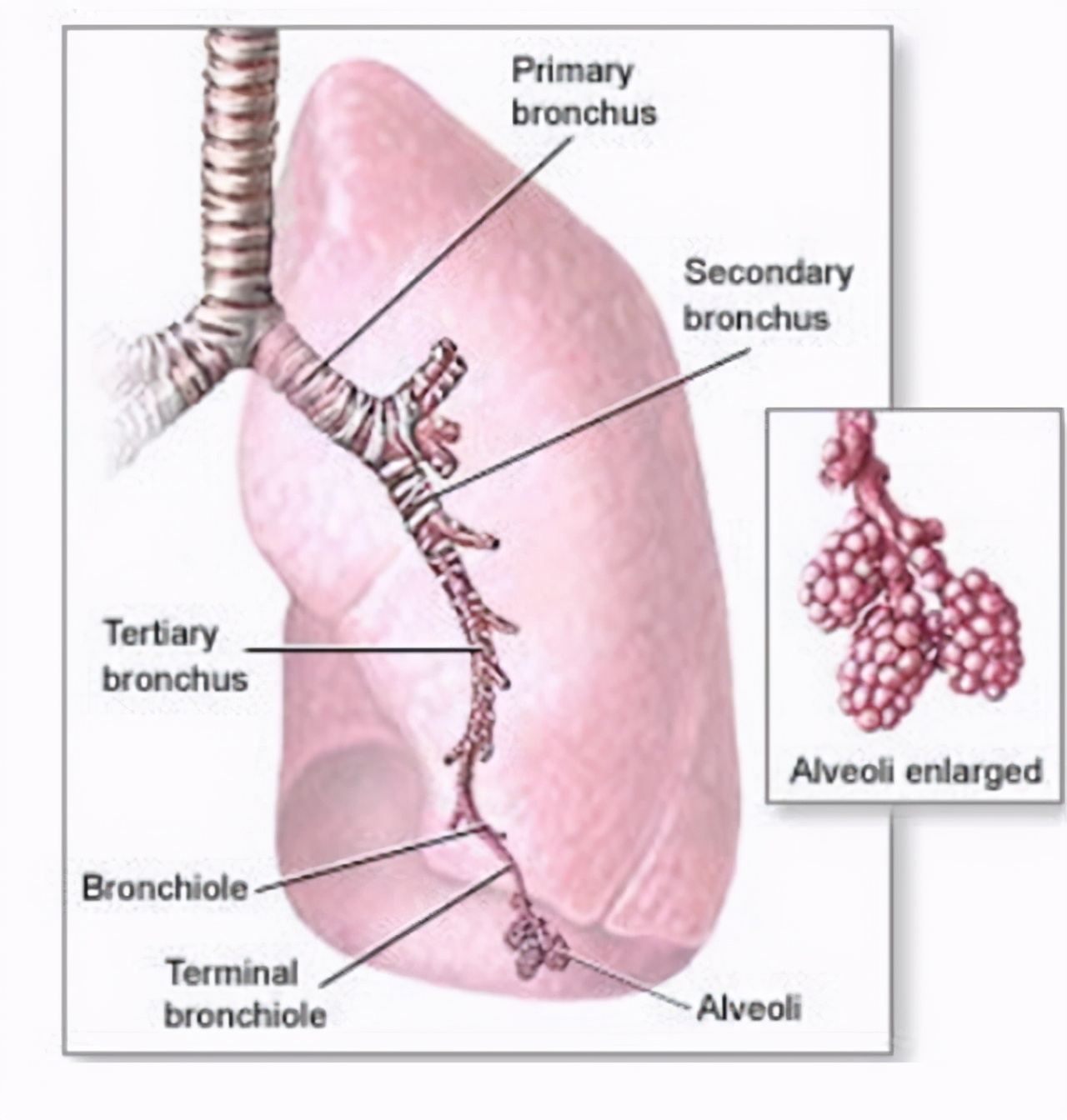 慢阻肺肺气肿的护理ppt,肺气肿不可逆怎么回事