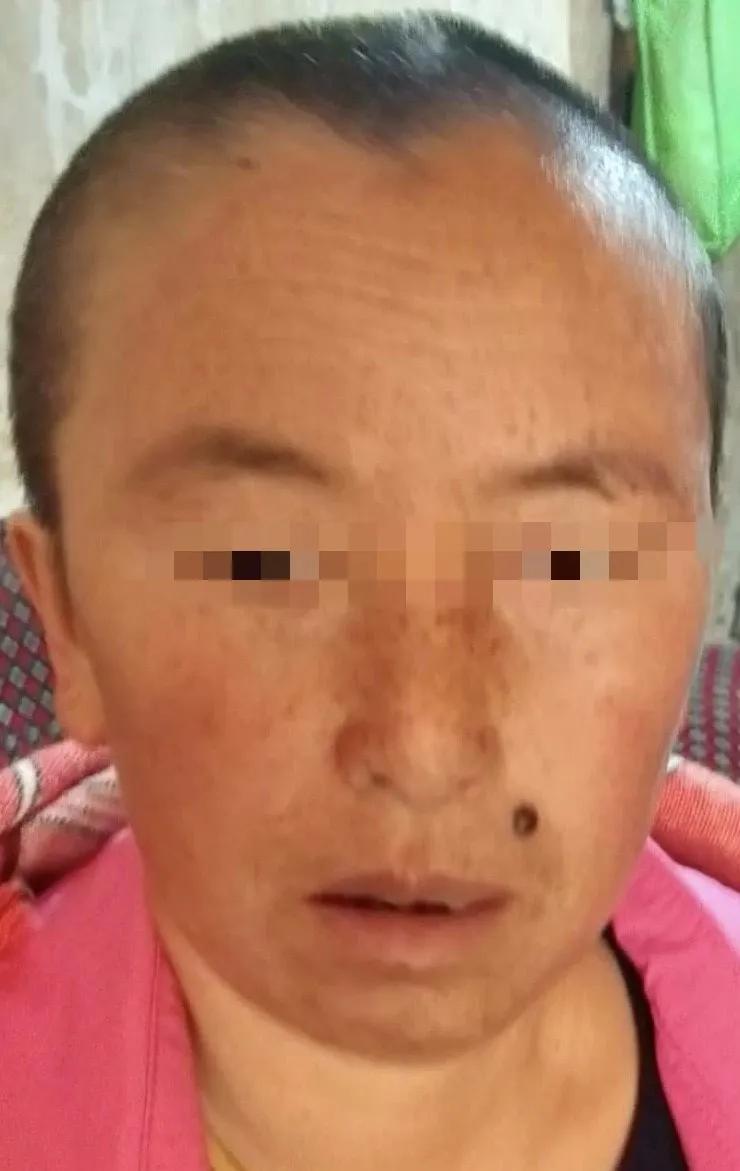 见微知著,内镜显神通