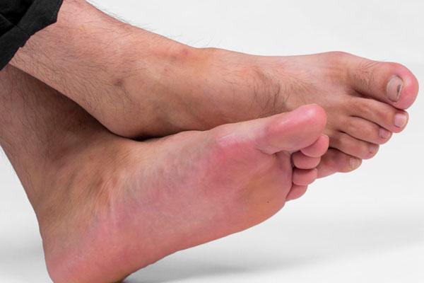 脚臭的人脱鞋会不会很尴尬,有脚臭脱鞋怕尴尬怎么办