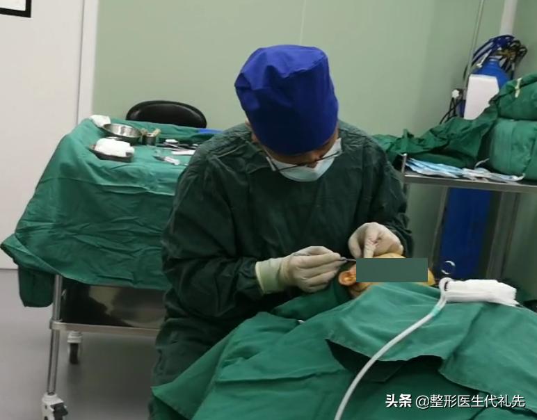 49岁女人做小拉皮术后恢复,50岁女人拉皮手术后脸变化