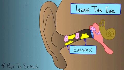 耳屎一定要全部清除吗,耳屎到底要不要挖终于知道答案了