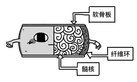 婆婆腰间盘突出怎么办,腰椎间盘突出和婆媳矛盾有关系吗