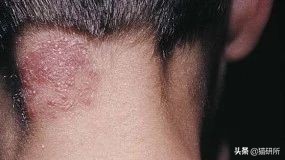 铲屎官得了猫癣怎么处理,铲屎官必知猫咪急救办法