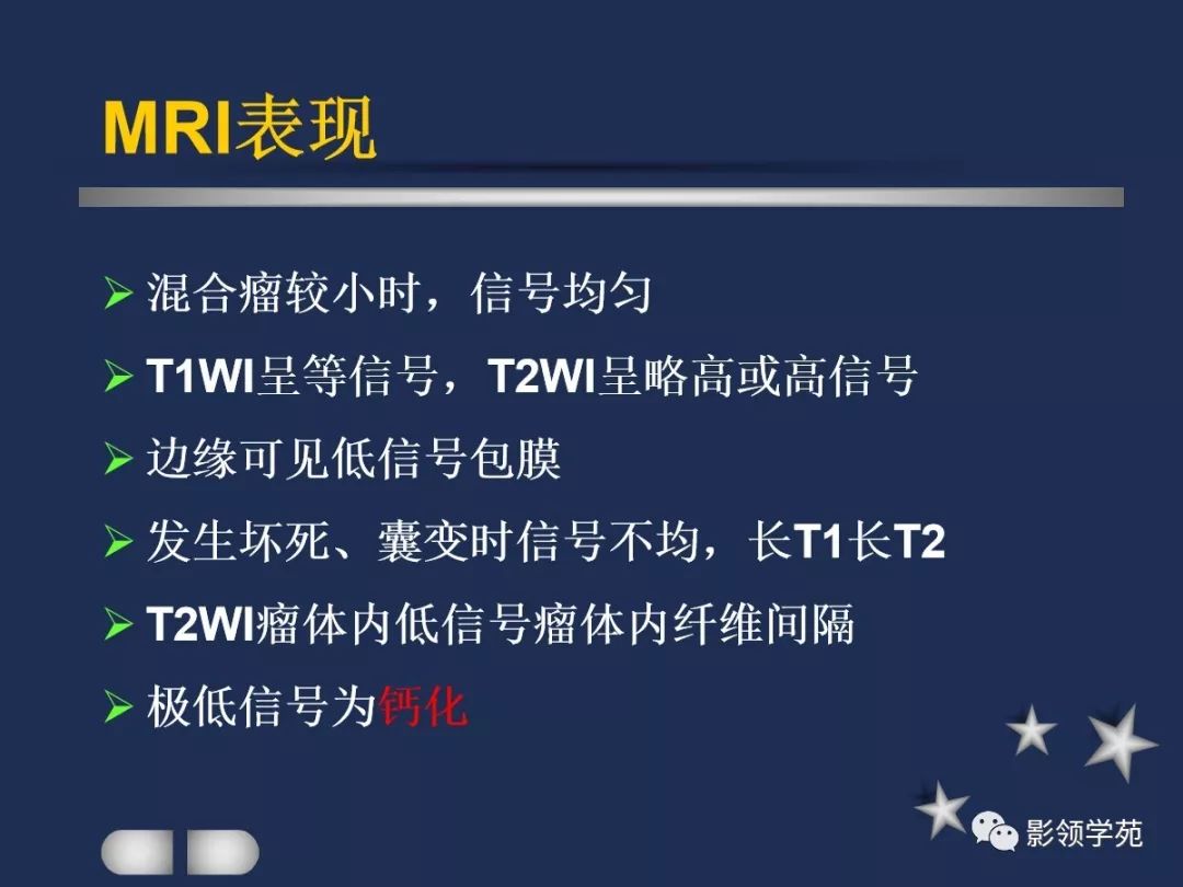 腮腺疾病影像学诊断,腮腺肿块影像诊断