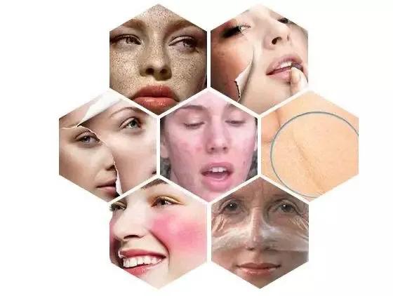 敏感肌到底可不可以刷酸,敏感肌肤可以刷酸的产品