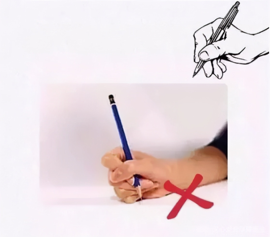 小儿歪头怎么治疗,小孩子面部倾斜怎么改正