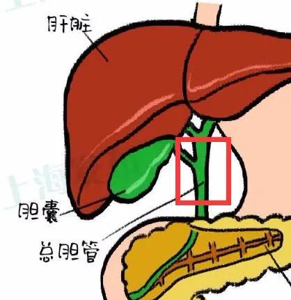一招解决胆结石的方法,胆结石最快止疼方法穴位