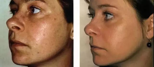 黄圣依洗面奶,黄圣依洗面奶真的有效果吗