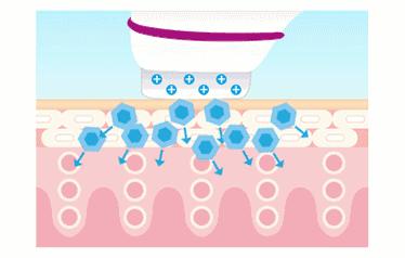 黑头多怎么办如何去除黑头,黑头贴去除顽固黑头