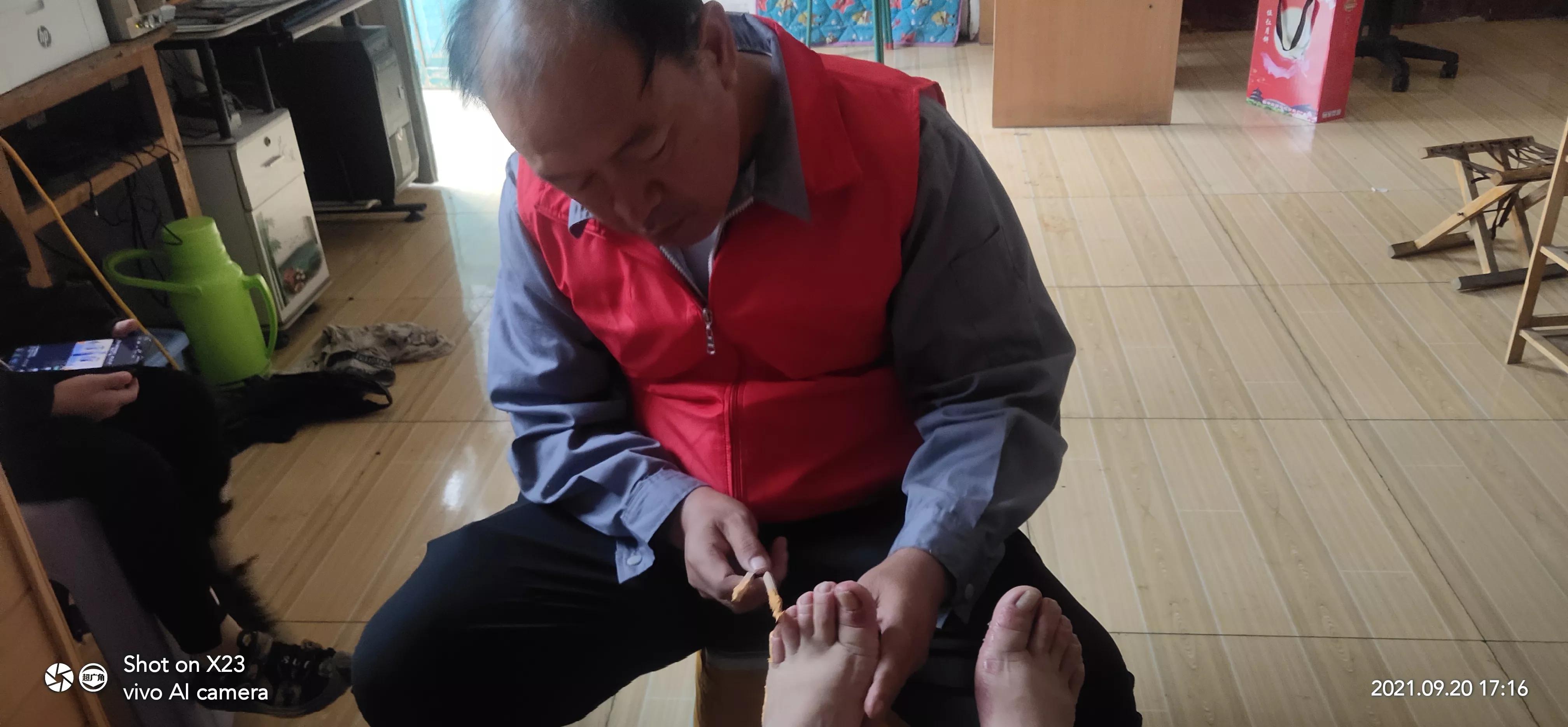 邹平皮肤病诊疗所,大名县农村偏方专治皮肤病