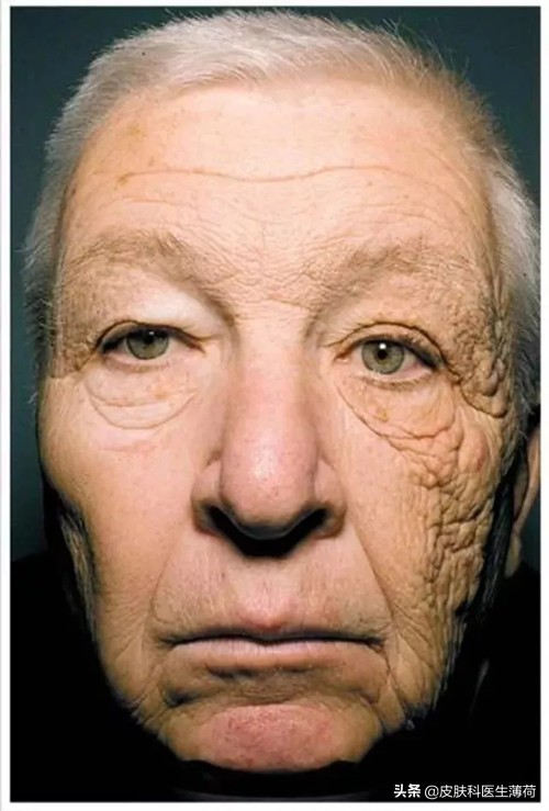 如何防止光老化氧化,预防光老化的最佳方法