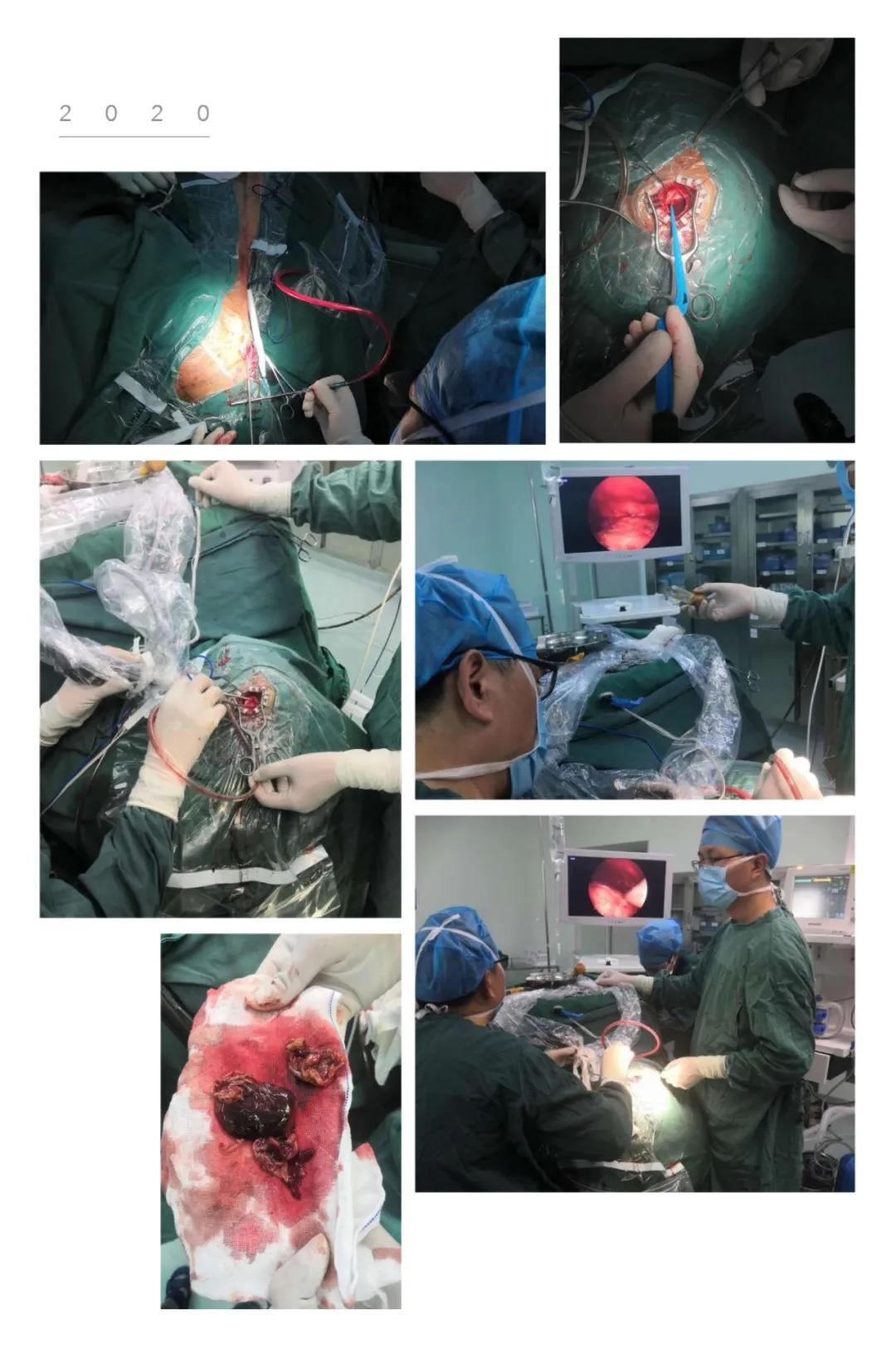 泉州:突破!永春县总医院成功开展新技术