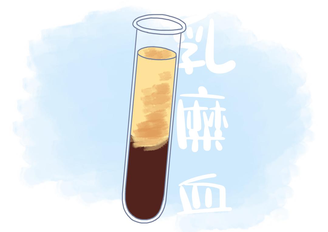 血常规体检的这个指标很重要,体检血常规各项指标及说明