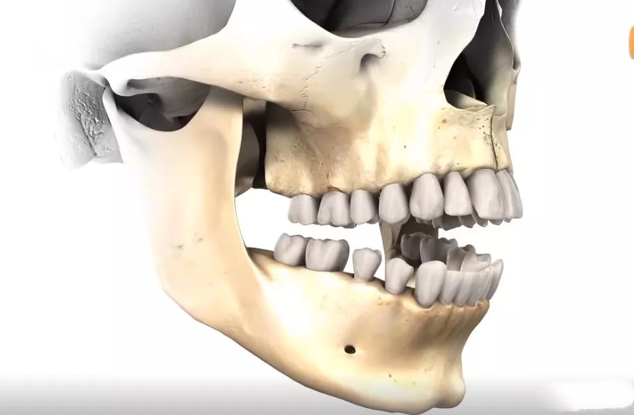 蔡徐坤整牙前后对比图片,蔡徐坤整牙前图片