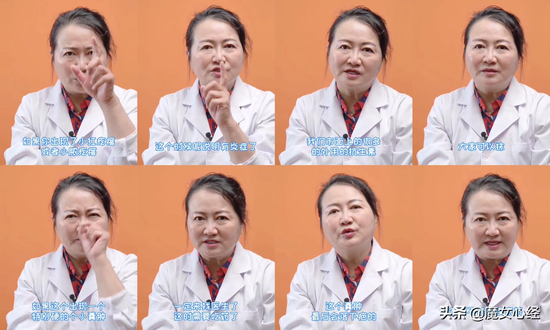 什么样的痘痘可以选择护肤品治疗,痘痘怎么用护肤品治疗