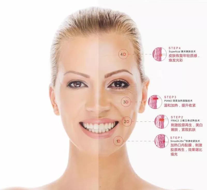 皮肤激光中心元旦,春节优惠活动