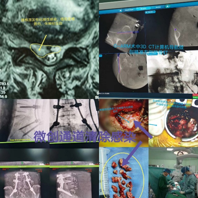 牙齿不好引发的疾病视频,牙齿有问题不做根管治疗会怎么样