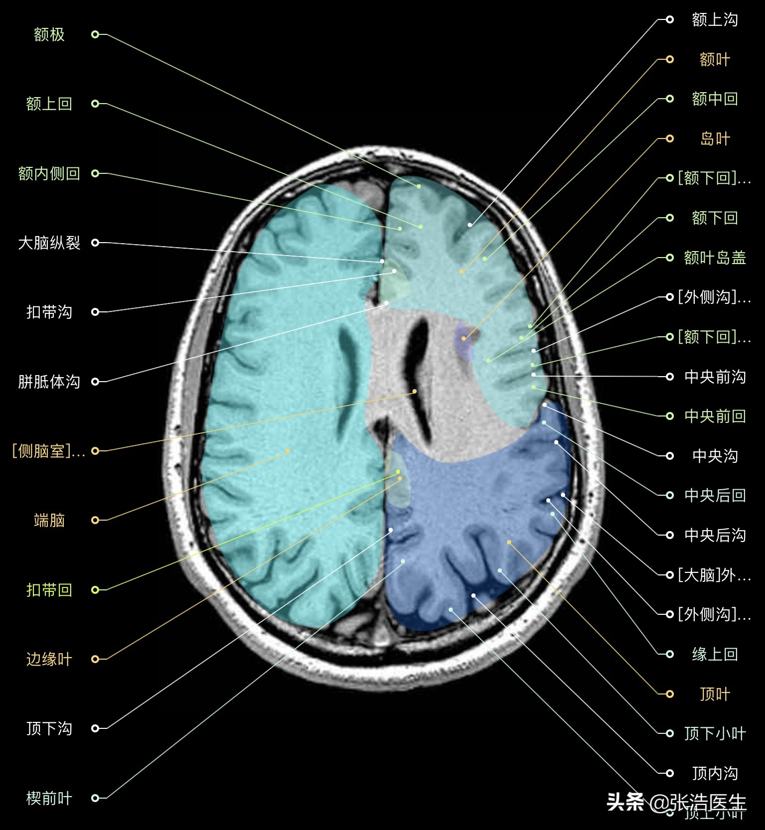 颅脑mri断层解剖视频课件,颅脑mri解剖手绘图