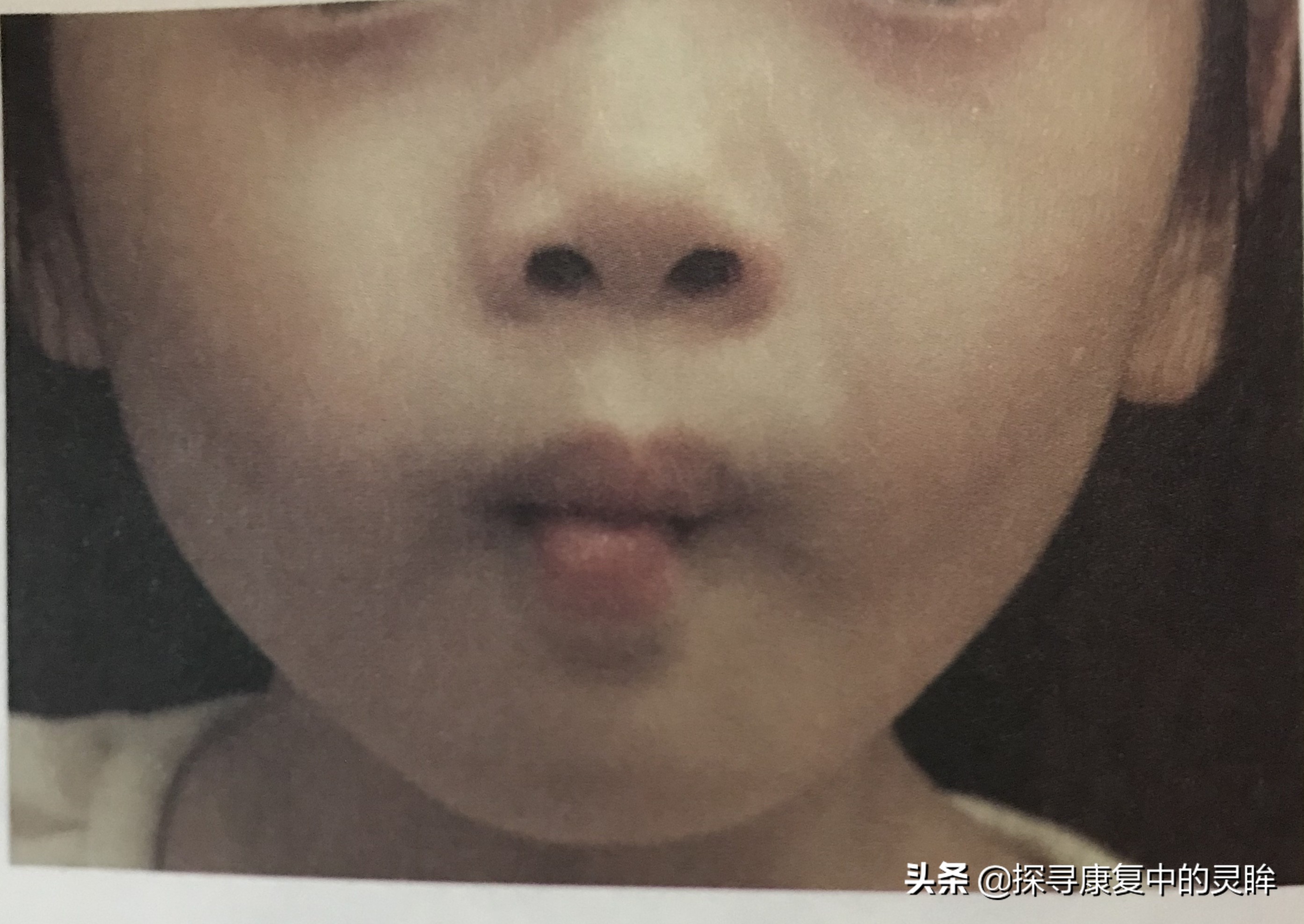 五种口部运动:灵活孩子的樱桃小嘴,让他们说话更清晰(超简单)