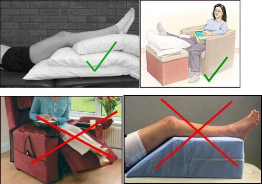 膝关节置换后肿胀可用盐袋热敷吗,膝关节置换50天仍然肿胀吃什么药