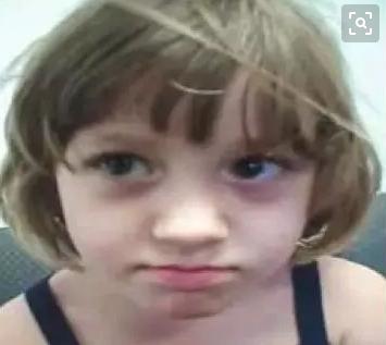 过敏性鼻炎眼袋黑,为什么儿童过敏性鼻炎下眼袋发黑