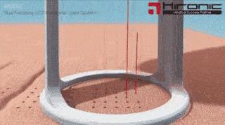 带你了解激光美容走出10个误区,激光美容的12个误区一定要记清