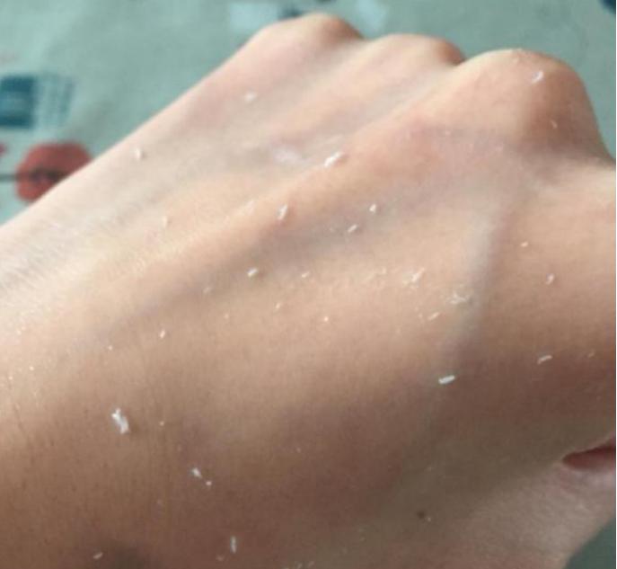 t区出油是什么肤质两颊起皮,冬天鼻子两颊起皮是什么肤质