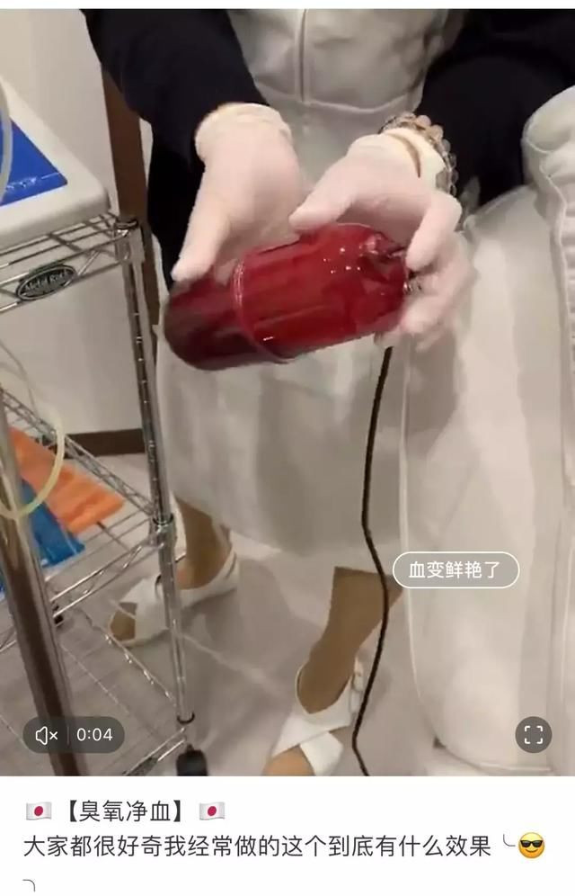 花三万换血15次,一周两次换血净化血液垃圾