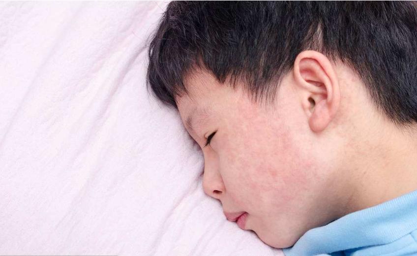 五岁小朋友半夜突发高烧,6岁女儿持续高烧6天了