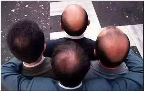 想要植发有哪些常识需要知道,植发了解些什么