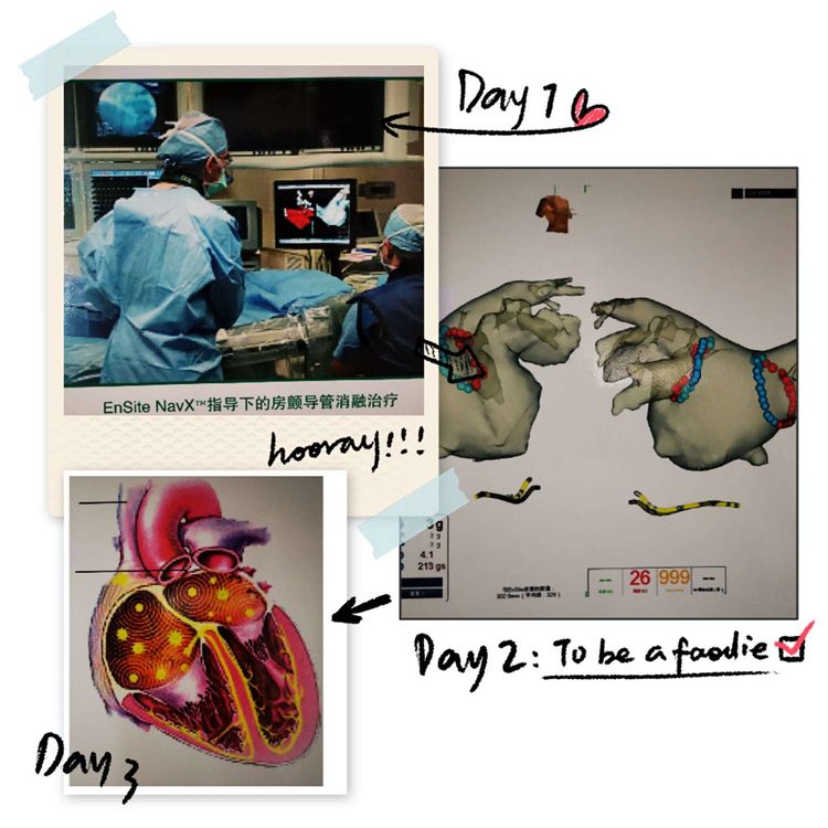 房颤病人随访,房颤射频手术病人的护理诊断