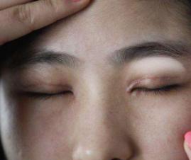 鍖栧鍝佸鑷寸櫧鐧滈,鍖栧鍝佸鑷寸櫧鐧滈浜嬩欢