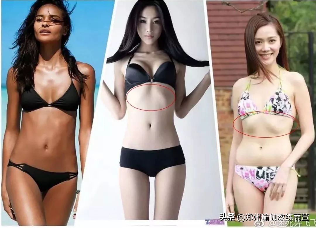 肋骨外翻会有后背疼是怎么回事,右侧肋骨外翻隐痛要警惕三种病