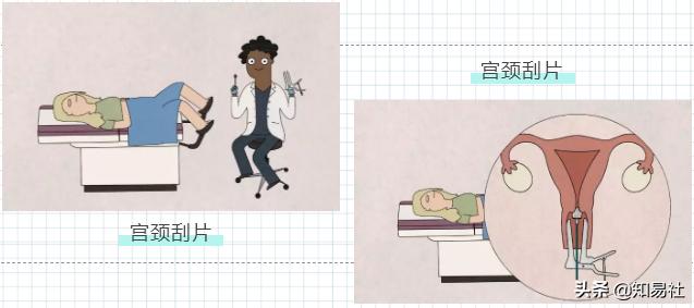 羞羞后警惕HPV感染,一不小心会得宫颈癌