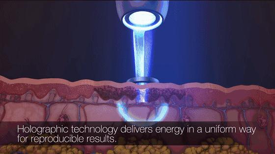 传说中效果倍儿好的超皮秒祛斑，真的这么神奇吗？