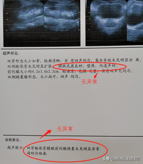 青少年有血尿怎么回事,青少年突然尿血和便血是怎么回事