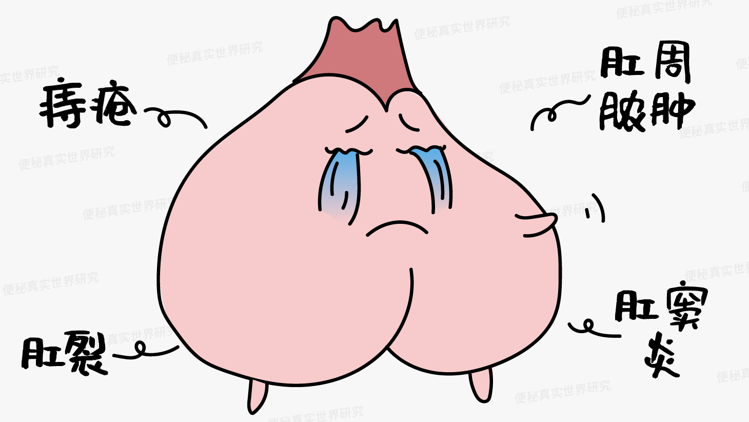 菊花痛的几个等级，反映出6种不同的肛门疾病