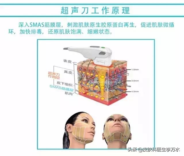 张雨绮说超声刀就像在烤肉？！线雕和超声刀，究竟哪个更靠谱？