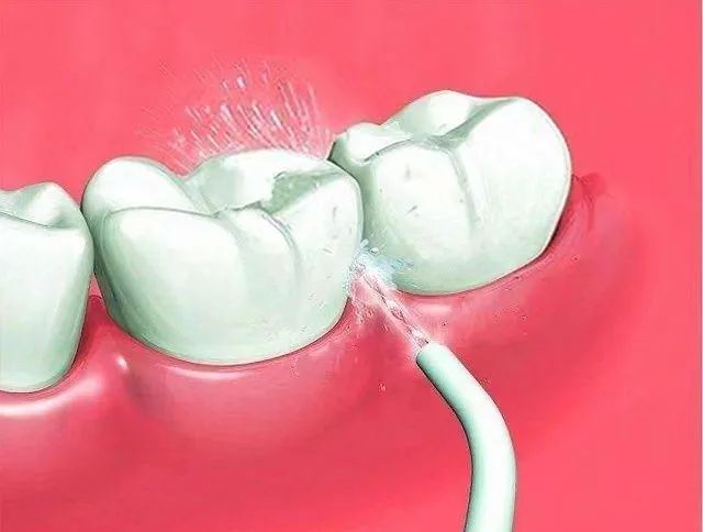 漱口水牙贴使用顺序,漱口水推荐温和呵护口腔