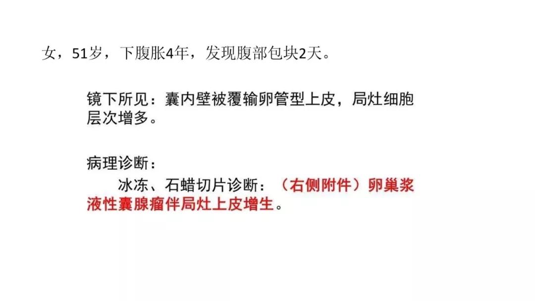 卵巢原发肿瘤的分析思路