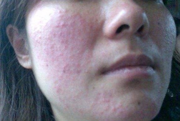 温和无刺激防过敏的防晒霜,防过敏防晒霜敏感肌品牌