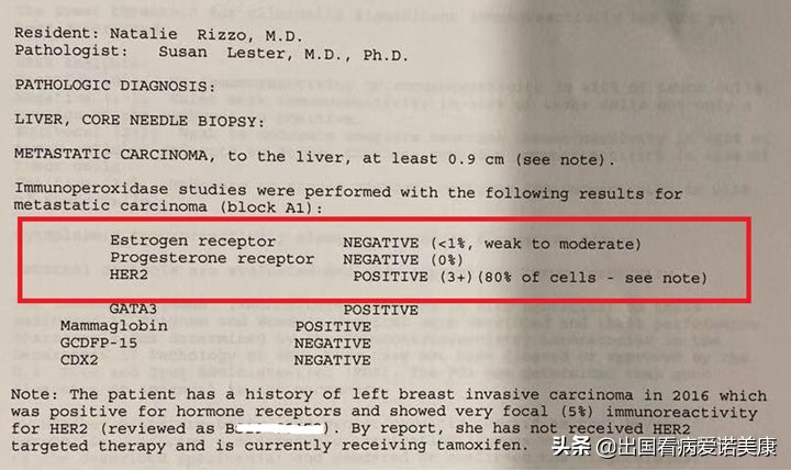 乳腺癌晚期美国治疗得更好吗,美国最先进的乳腺癌治疗方案