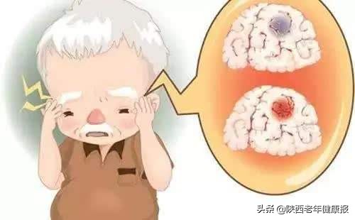 感觉头昏昏沉沉是中暑了吗,天气热头昏沉沉的什么原因