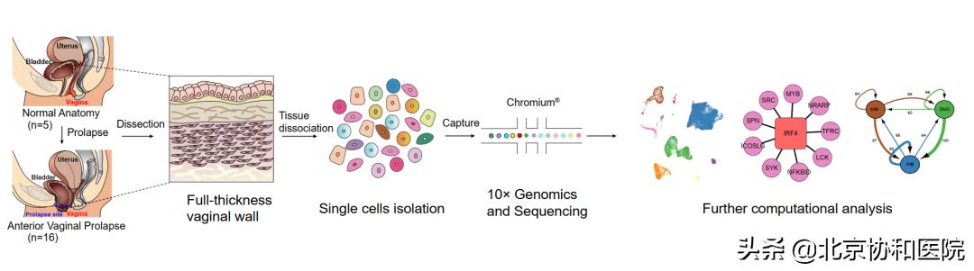 协和医院妇产科专家朱兰教授,协和妇科朱兰